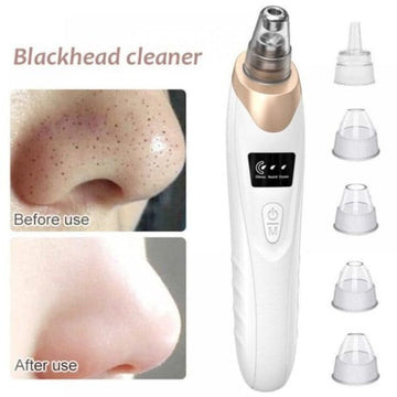 Electric Blackhead Remover & Pore Vacuum – 5-in-1 Acne & Deep Cleaning Tool